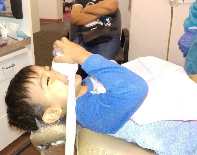 Picture of patient wearing laughing gas mask