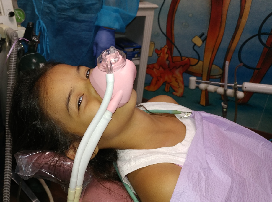 Picture of patient wearing laughing gas mask